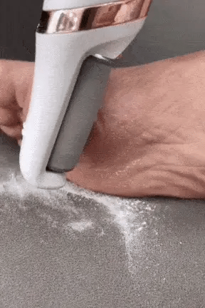 Electric Pedicure Foot File Callus Remover   مبرد قدم كهربائي لإزالة الجلد الميت والكالو